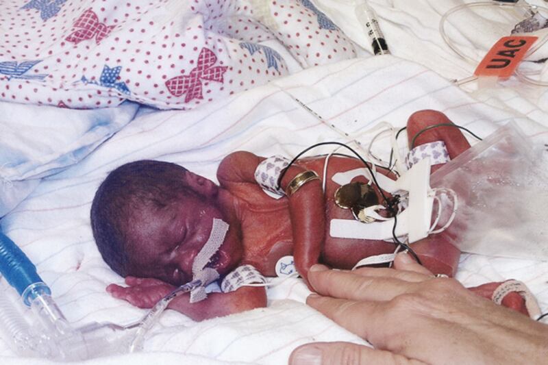 galleries/2012/04/13/baby-in-the-morgue-luz-milagros-and-more-miracle-babie-photos/miracle-babies-born-in-toilet_cqapun