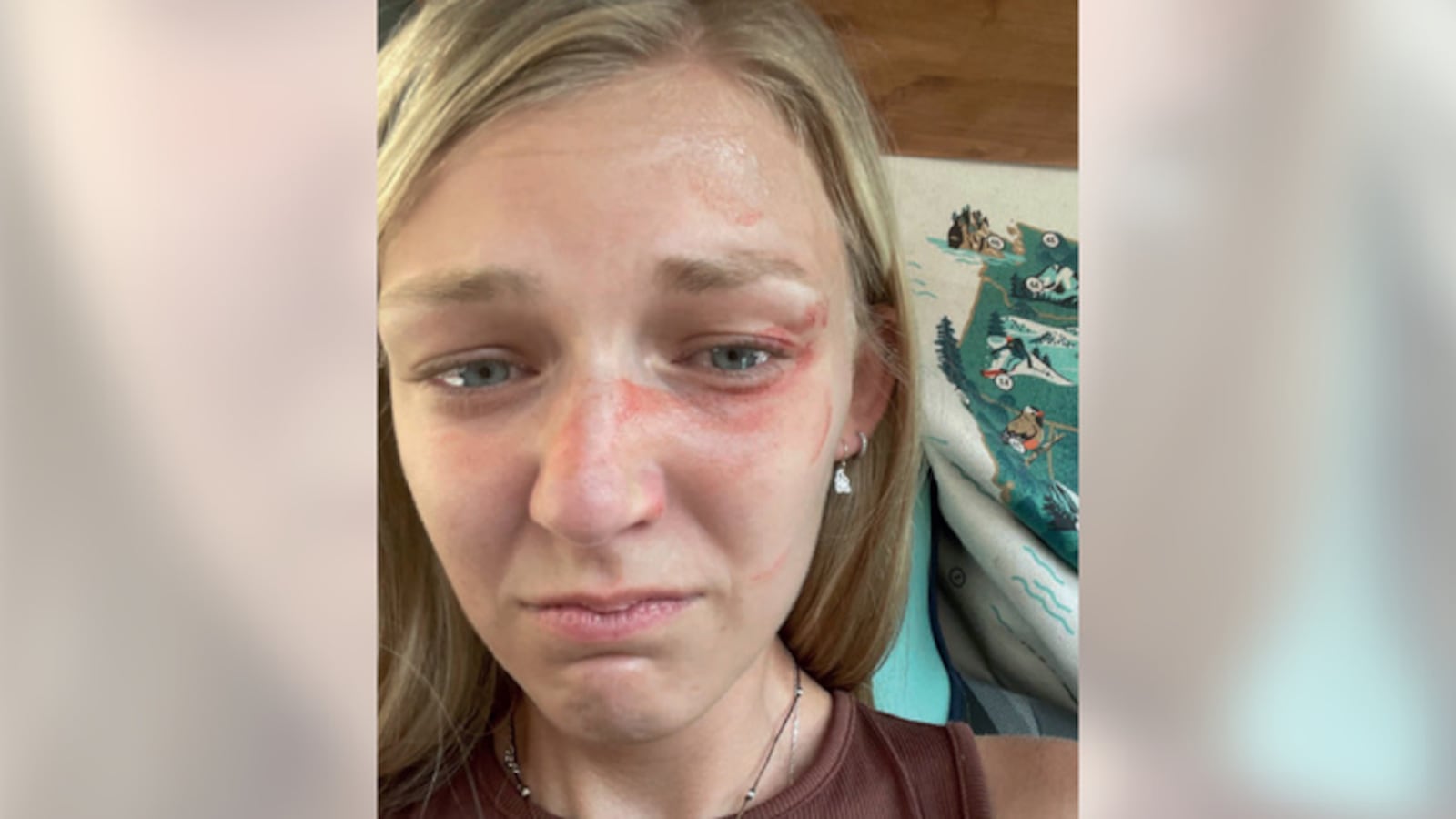 A selfie of Gabby Petito with bruises and red marks