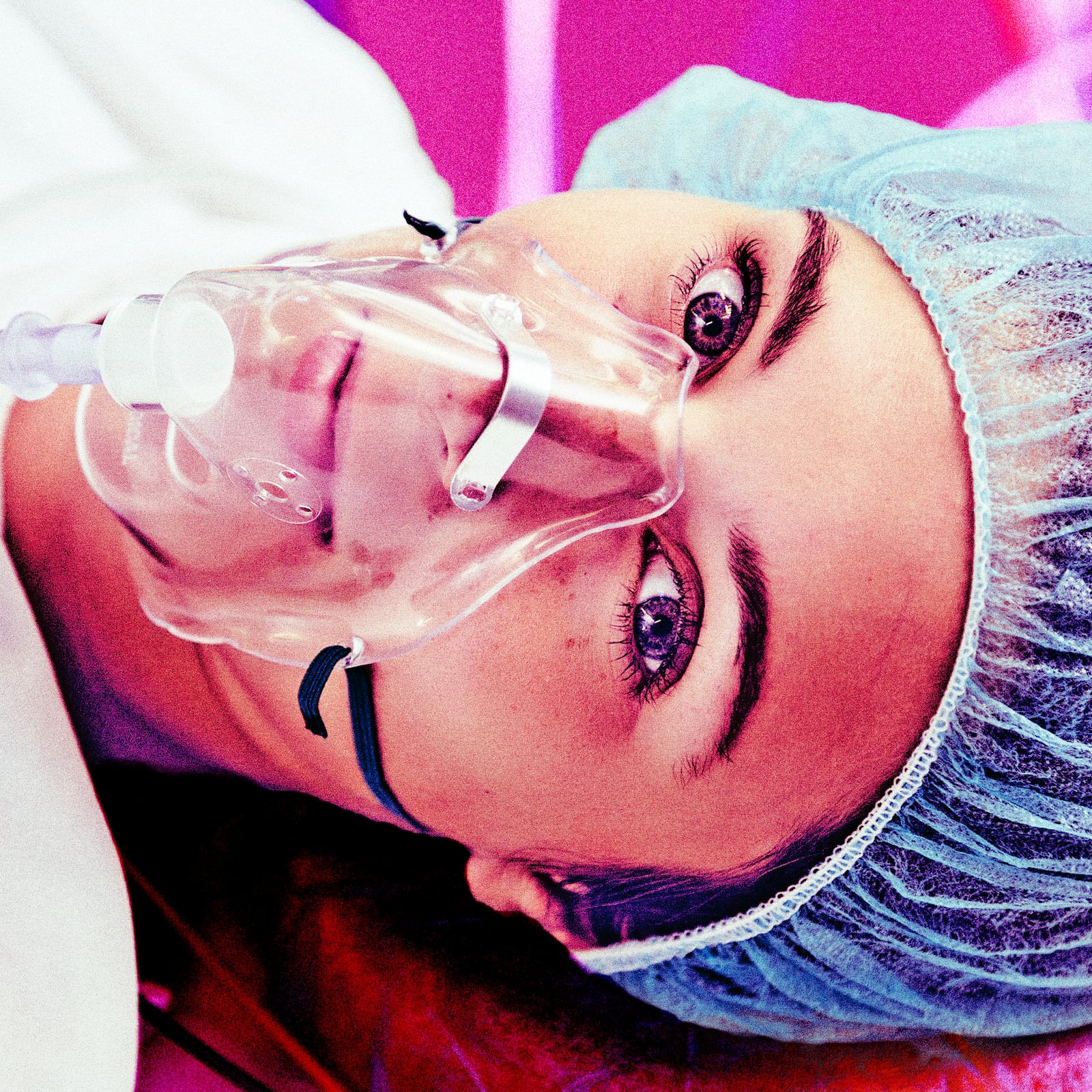A photo illustration of a patient with respiratory mask awake on operating room table.