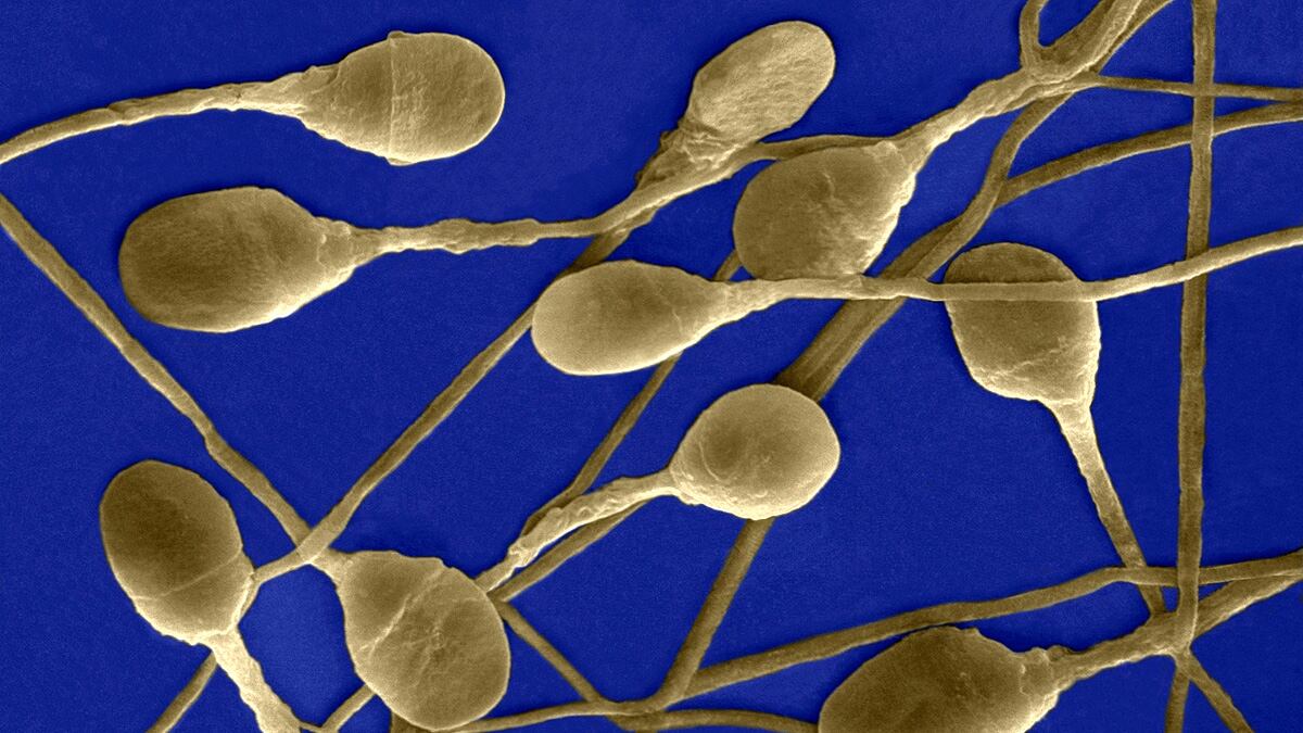 cheats/2012/04/09/british-man-fathered-600-children/sperm-generic-cheat_tirgft