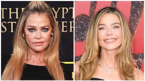 Denise Richards in April 2023 (left) vs. September 2025 (right). The actress underwent full facial rejuvenation in June 2025.