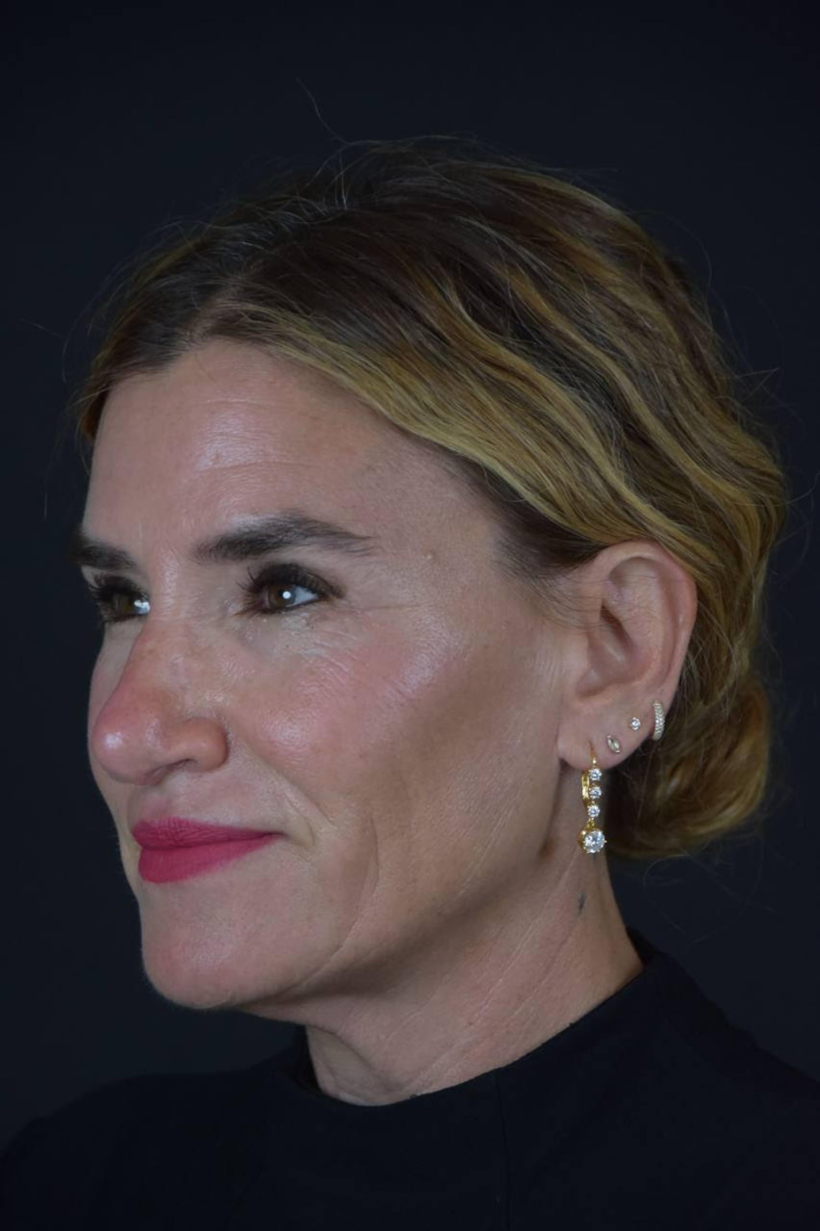 Dr. Sunder's patient Alli Webb