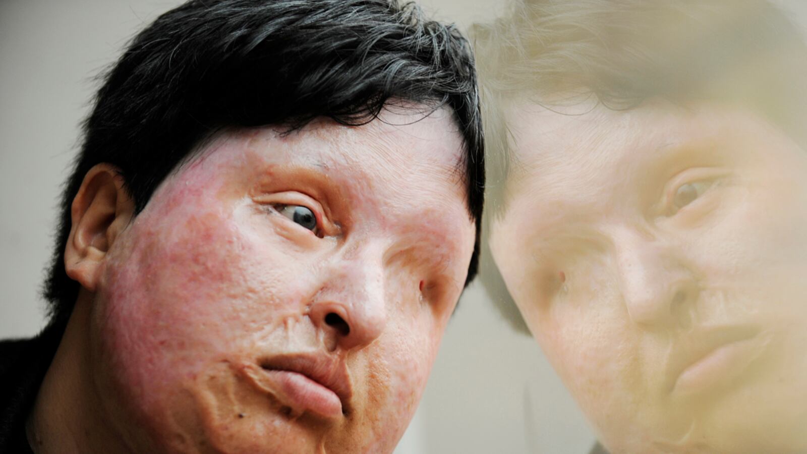 cheats/2011/07/31/woman-blinded-by-acid-spares-attacker/ameneh-bahrami-cheat_zy1fy5