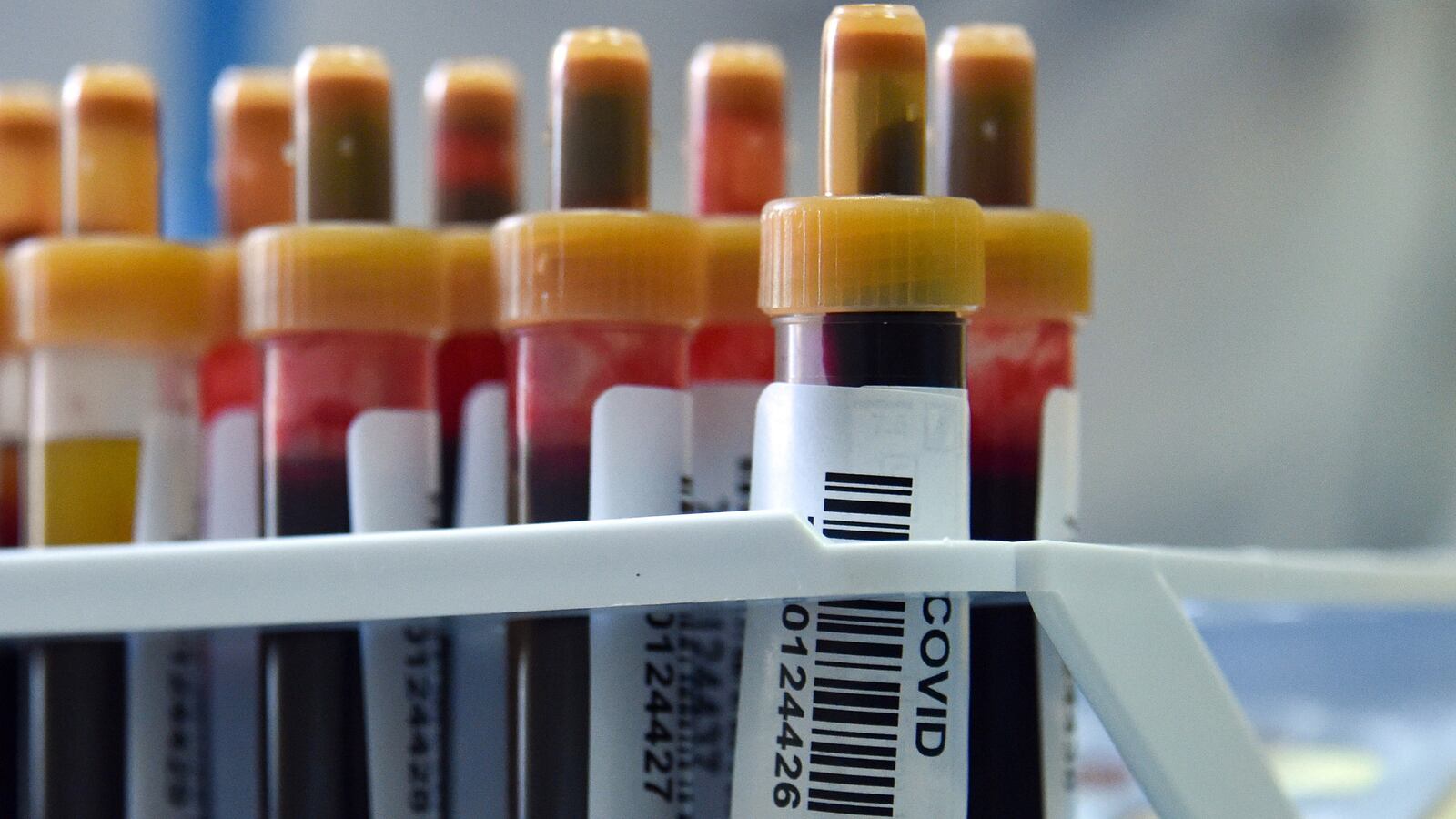 201014-axe-antibodies-tease_kndgyn