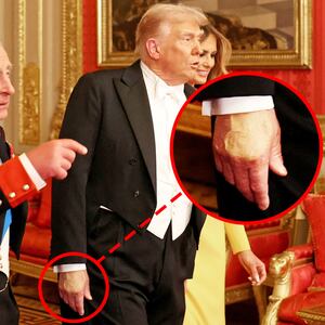 Red circle around Trump's hand makeup. Britain's King Charles, U.S. President Donald Trump and first lady Melania Trump walk to attend the State Banquet during U.S. President Donald Trump's state visit, at Windsor Castle, in Windsor, Britain, September 17, 2025.