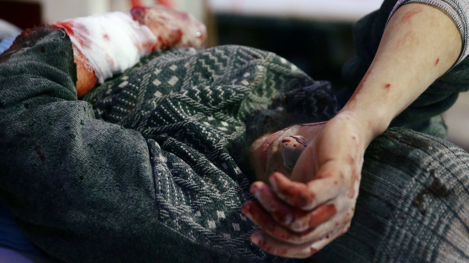 ghouta_xi531k