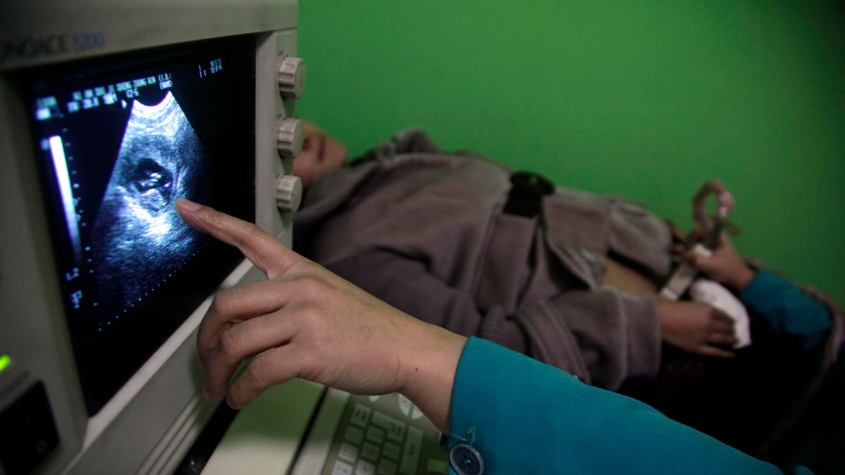 articles/2012/05/31/the-right-s-gendercide-crusade-to-limit-women-s-autonomy/same-sex-abortions-goldberg_teisls