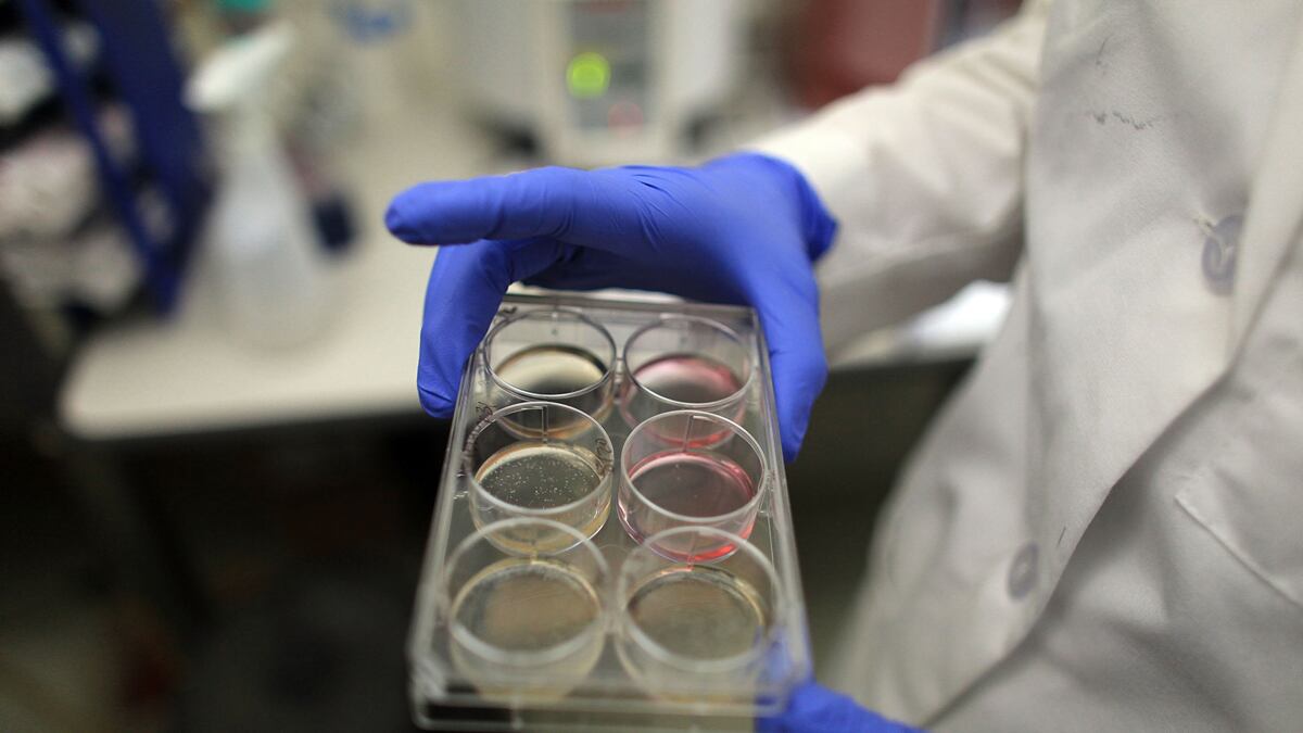 cheats/2011/07/27/obama-wins-stem-cell-suit/stem-cells-obama-cheat_afpi1w