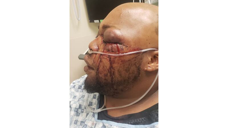 2023-06-27_Embed_zdiowc