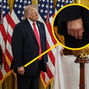 Makeup shown on Donald Trump's hand.