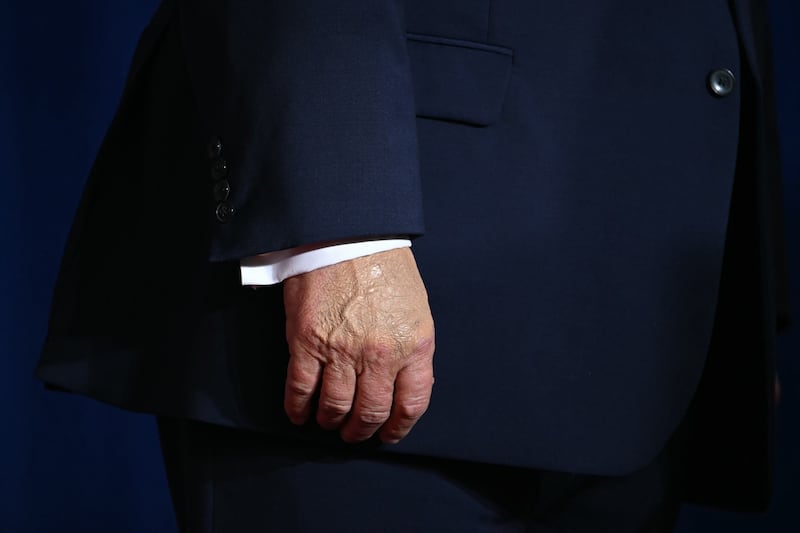 US President Donald Trump's hands are seen during a campaign rally at Pinnacle Bank Expo Center in Grand Island, Nebraska, on October 5, 2026. (Photo by Kent NISHIMURA / AFP via Getty Images)
