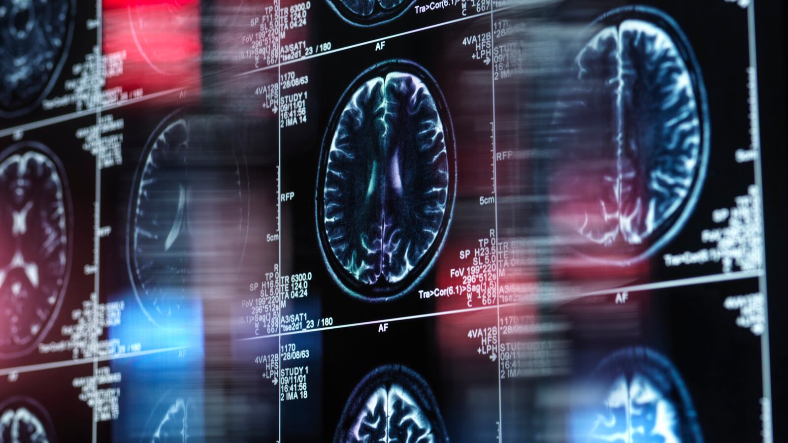 GettyImages-1414387544_1_g8ucp9