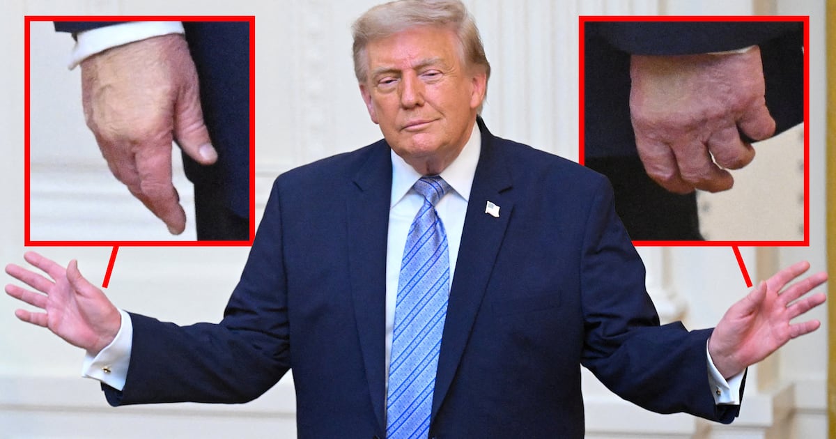 Trump, 80, Tries to Hide Chronic Health Issue During Primetime Speech