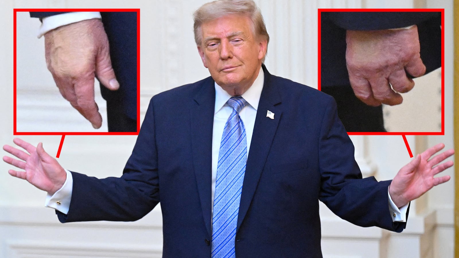Close-ups of Donald Trump's hands on July 16, 2026.