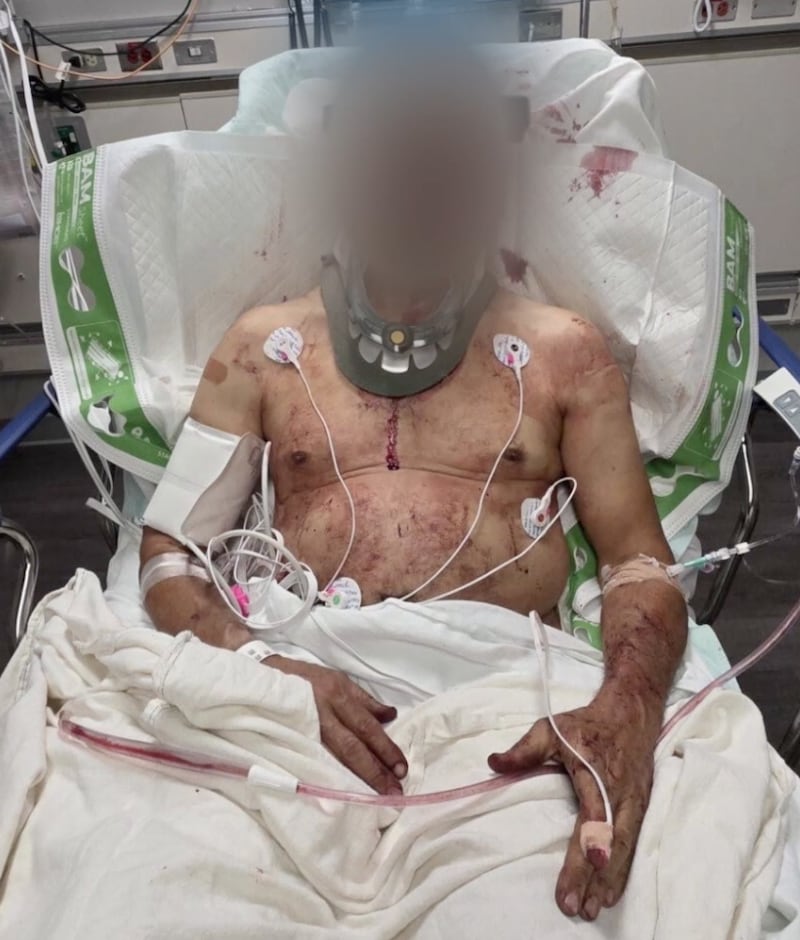 Stabbing Victim ,Mark Sanchez