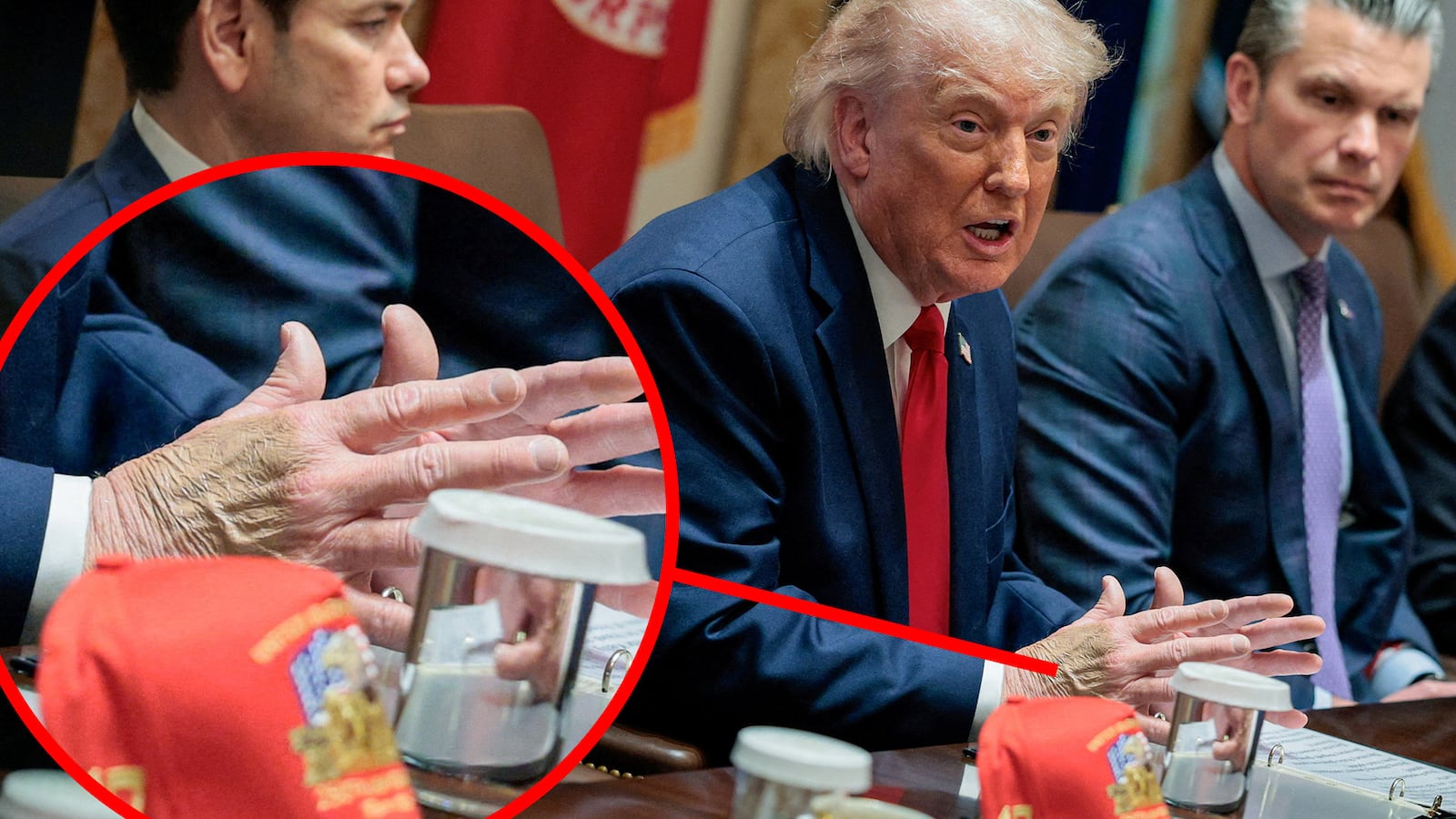 Donald Trump's bruised hand.