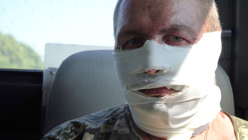 A wounded Ukrainian soldier with bandages on his face.