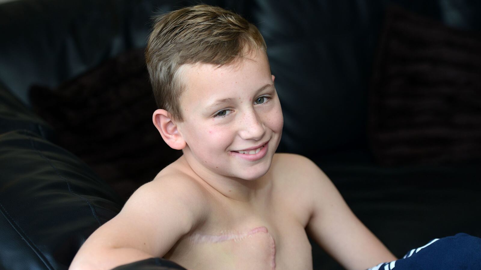 articles/2016/01/05/11-year-old-boy-undergoes-mastectomy/160105-lytton-boy-mastectomy-tease_efn0ta