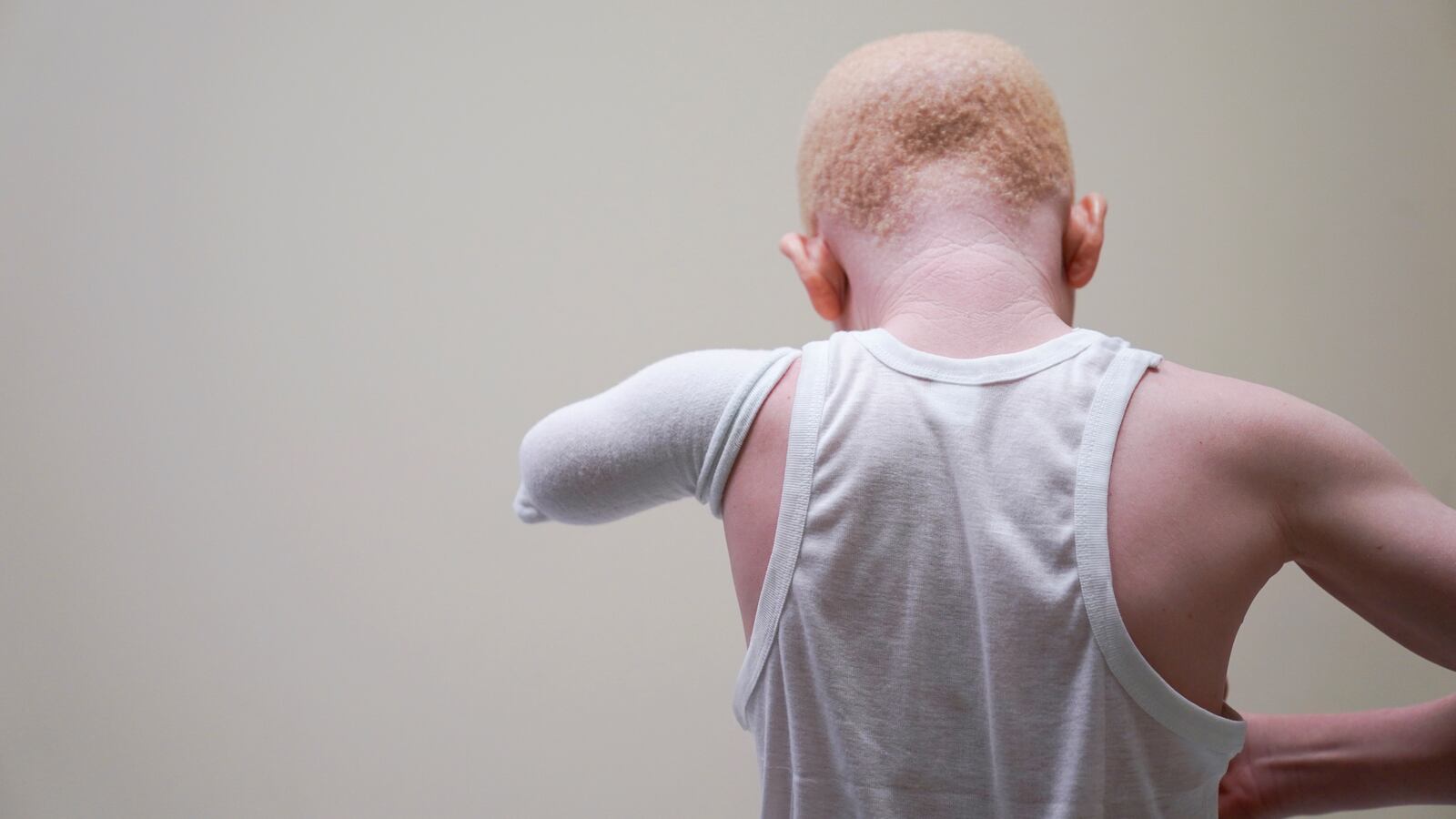 2019-08-14T172659Z_1_LYNXNPEF7D1GB_RTROPTP_4_USA-TANZANIA-ALBINISM_gorf7l