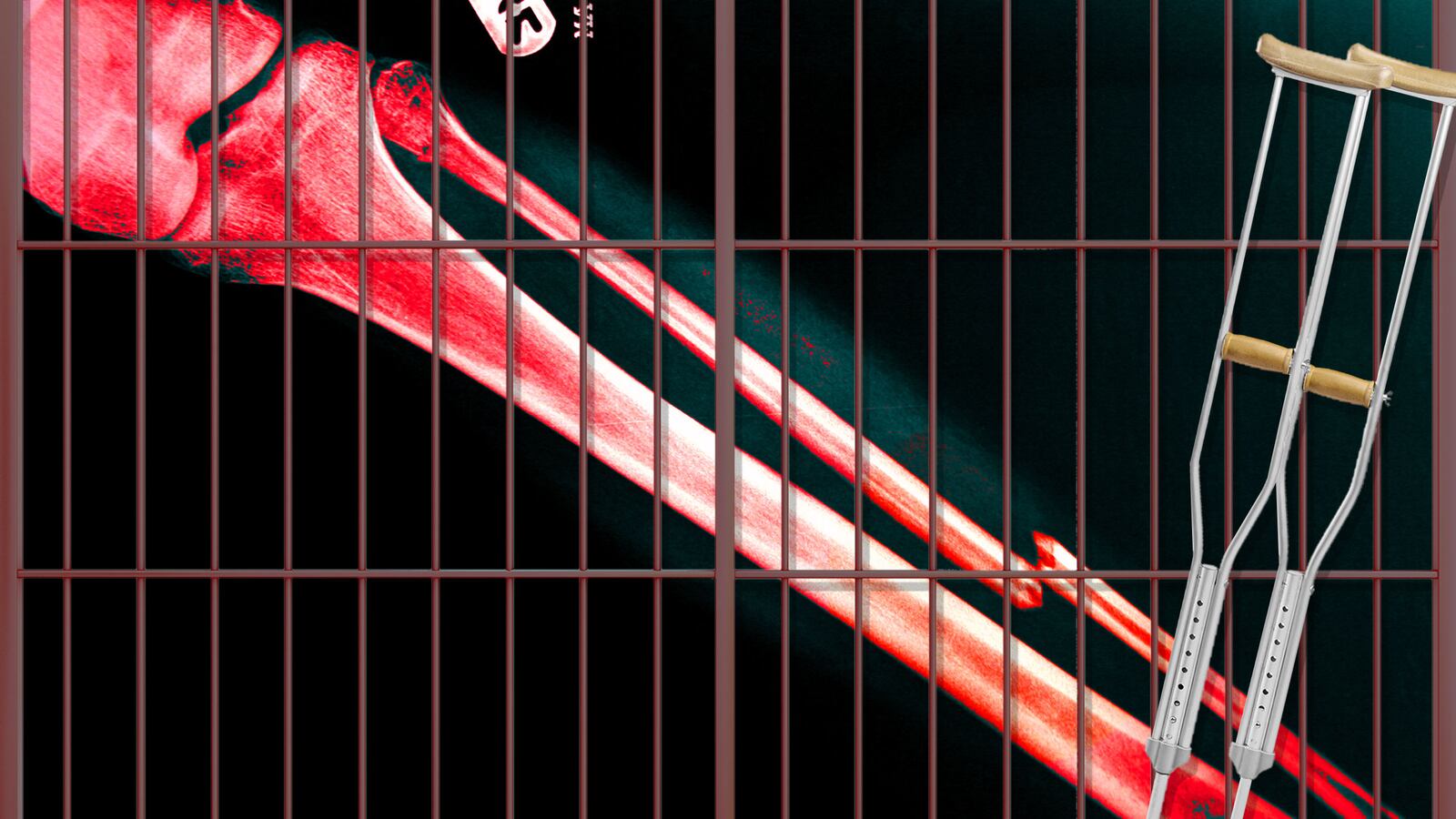 170818-plesset-prison-leg-hero_l4bvfy