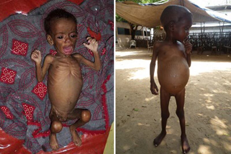 articles/2011/07/03/african-drought-in-sudan-and-somalia-breeds-famine-and-bloodshed/griswold-somalia-children-embed_ccf3of