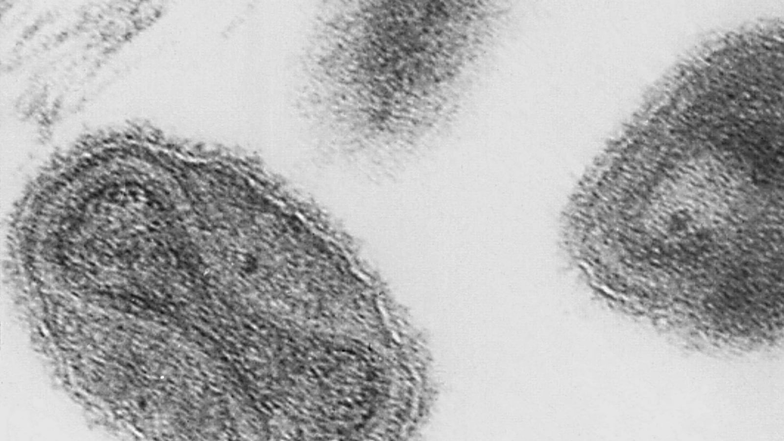 cheats/2014/07/08/small-pox-vials-found-in-box/140708-smallpox-cheat_pmqjfp