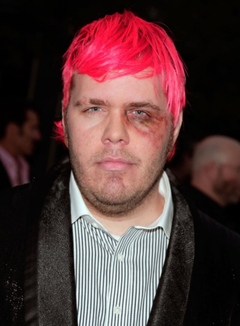 galleries/2012/06/13/stars-with-shiners-lady-gaga-reese-witherspoon-robert-downey-jr-madonna-others/hilton-stars-with-shiners_lxmgz3