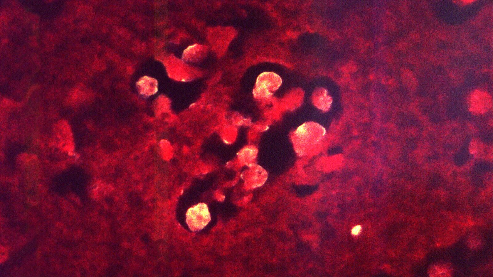 A brain-eating amoeba has killed a child in Nevada