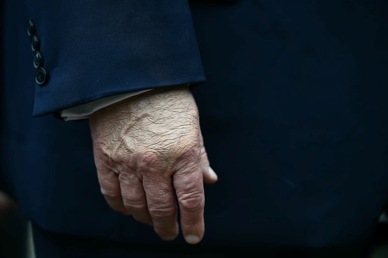 The president's makeup-slathered hand, as seen Thursday after he arrived in Dallas