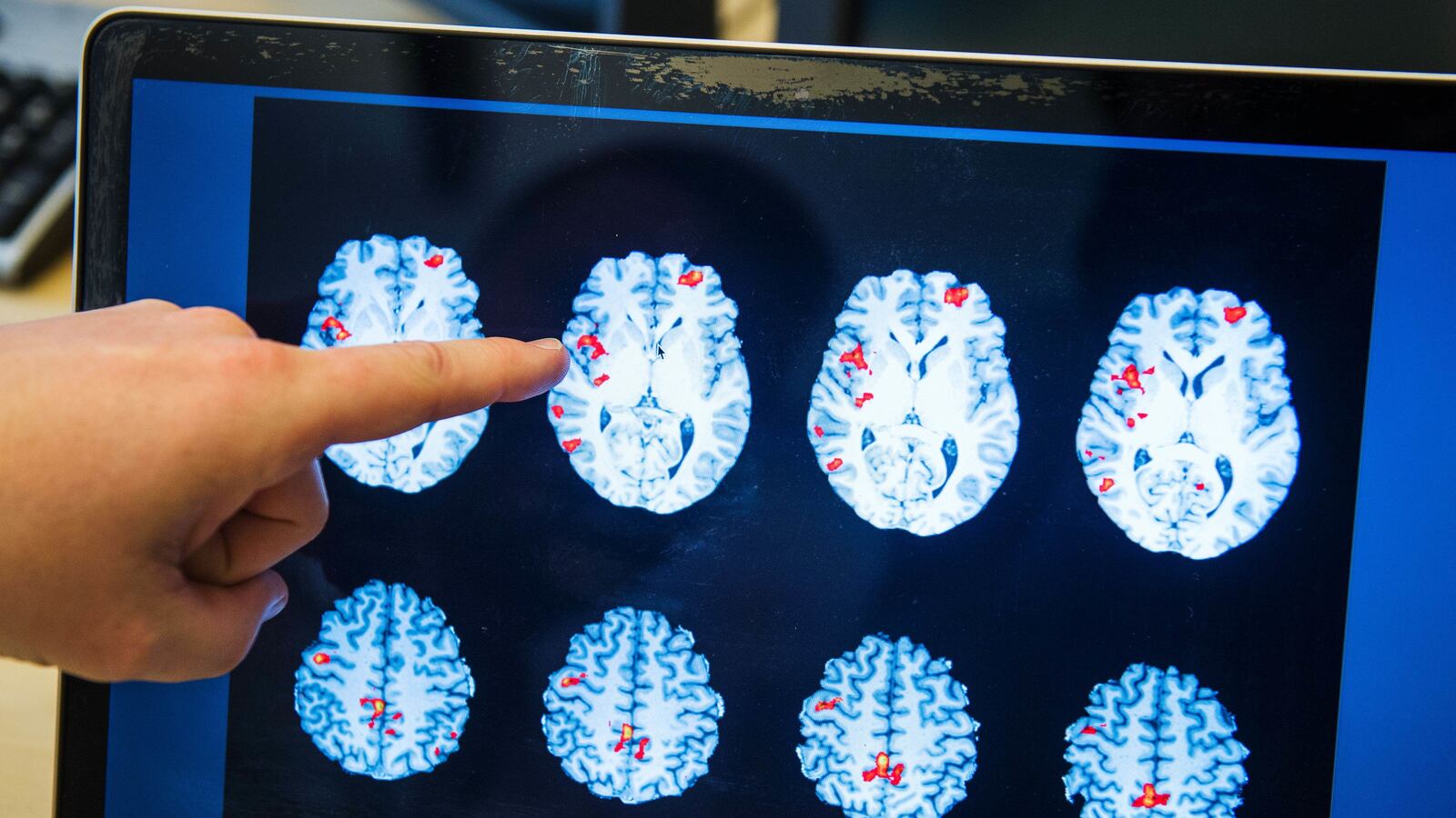 cheats/2017/04/19/study-psychedelics-induce-heightened-state-of-consciousness/170419-lsd-brain-scan_jxg1no