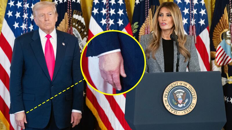Donald Trump, his hand makeup, and Melania Trump.