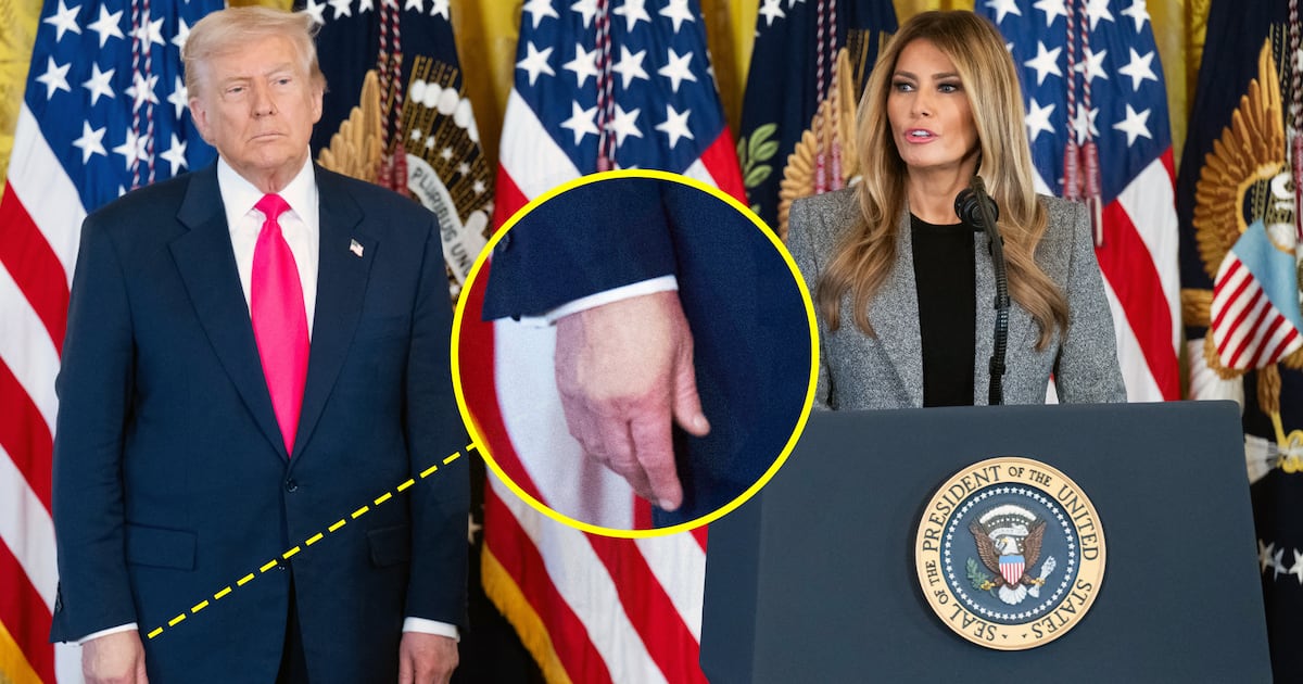 Trump, 79, Wears Hand Makeup for Melania Speech Trump, 79, Wears Hand Makeup for Melania Speech