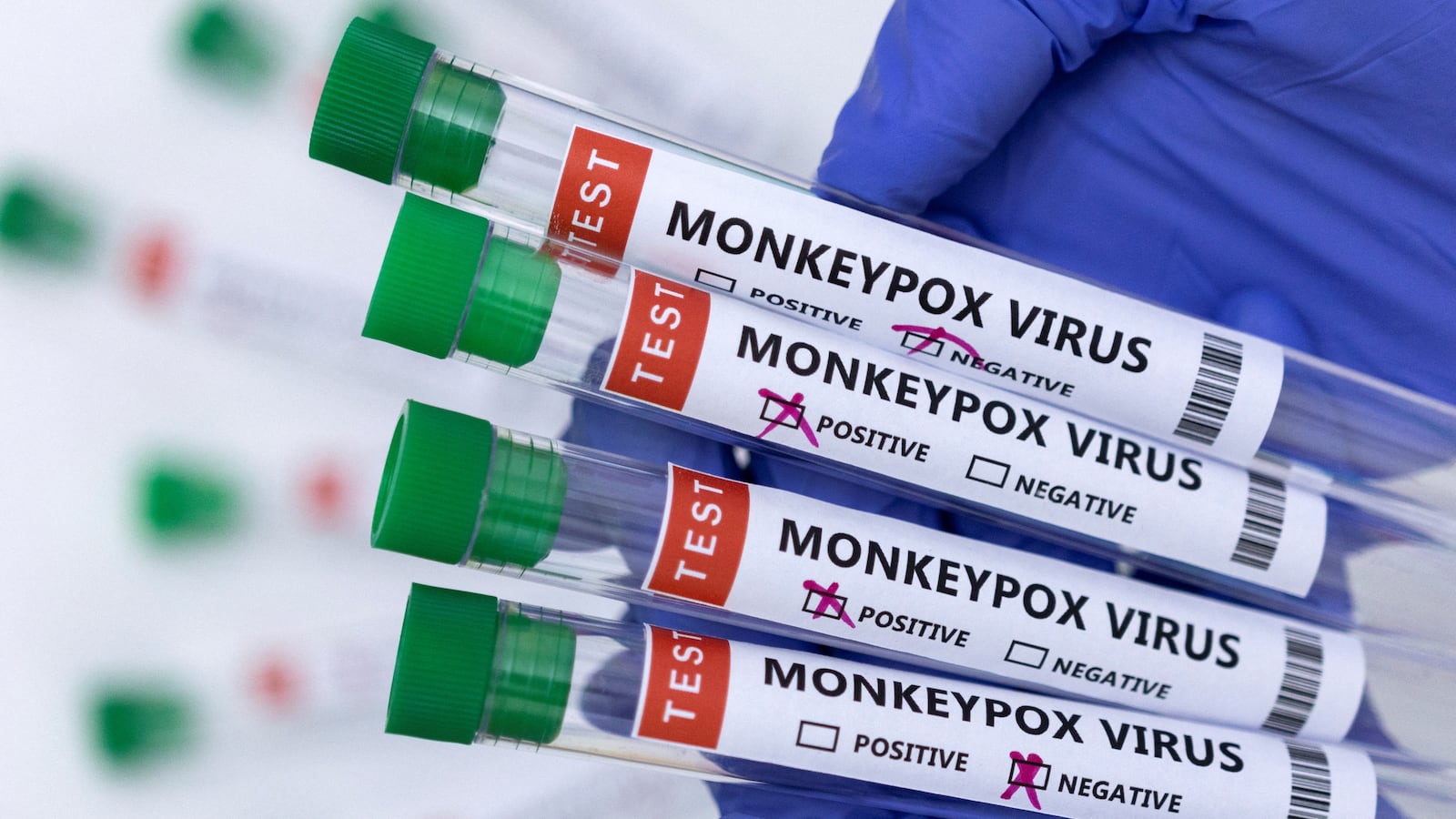 nine_monkeypox_yf6tbo