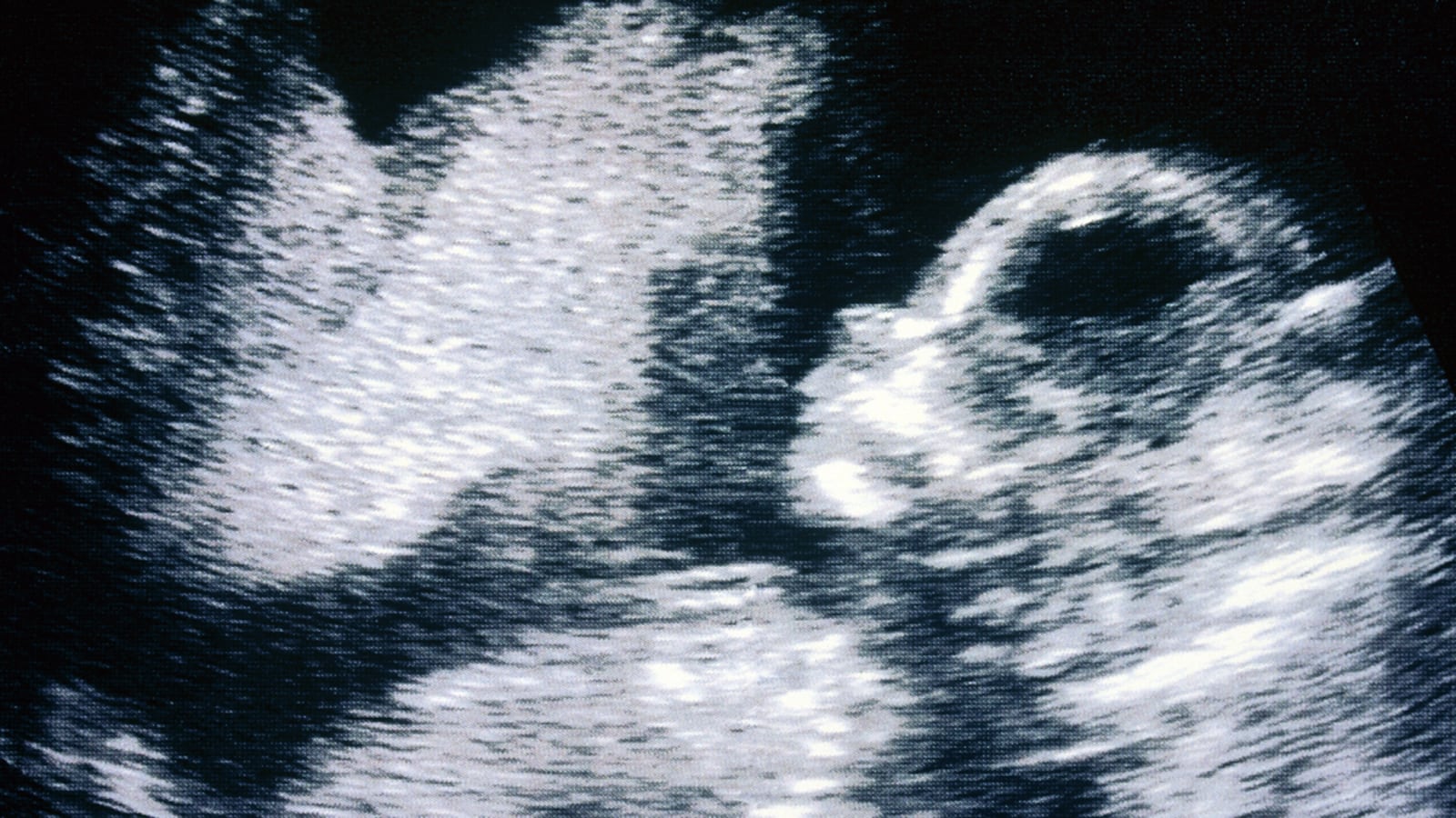 articles/2012/04/12/governor-jan-brewer-signs-arizona-s-extreme-new-abortion-law/arizona-aboration-law-yarrow_huwnum