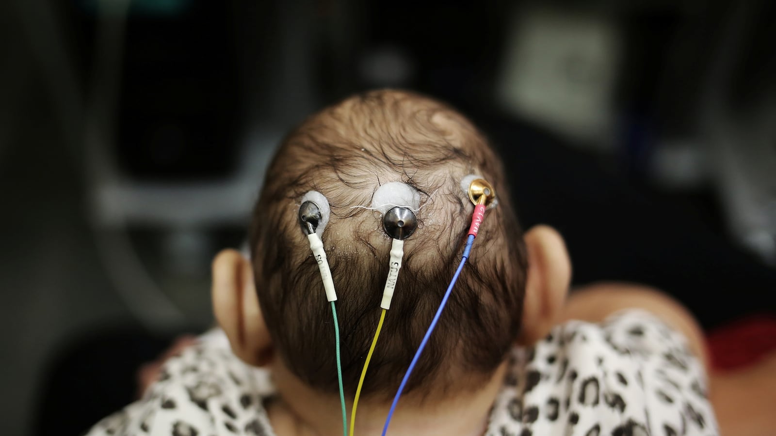 articles/2016/06/02/zika-s-arrived-america-needs-to-quit-yawning-and-pay-attention-to-women-s-health/160602-Karkowsky-zika-us-tease_o7n7mv