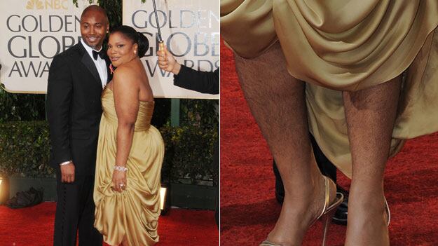 galleries/2010/01/19/wild-and-woolly-stars/hairy-celemonique_ssfodj