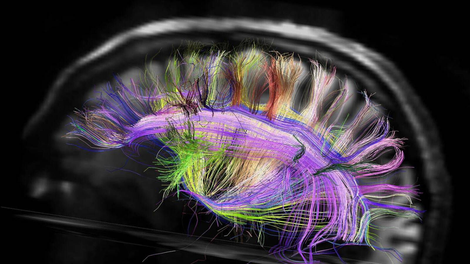 articles/2012/04/04/neuro-smackdown-scientists-debate-how-to-solve-the-mystery-of-the-brain/connectome-debate-schwartz-teaser_ejbit2