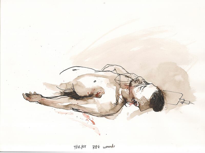 galleries/2014/02/28/steve-mumford-s-graphic-war-journals/140227-mumford-soldier-with-wound_iswuvf