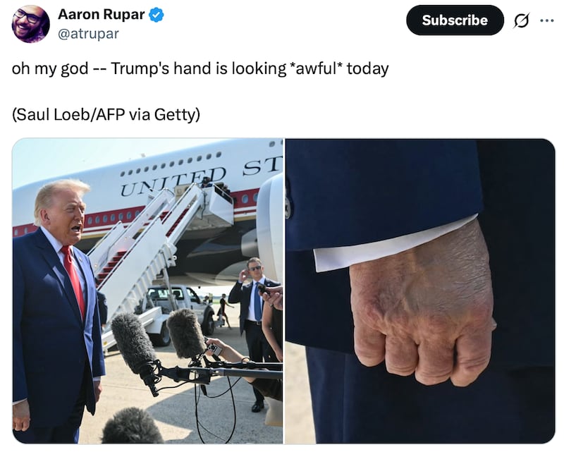 Journalist Aaron Rupar calls out Trump's "awful" hand.