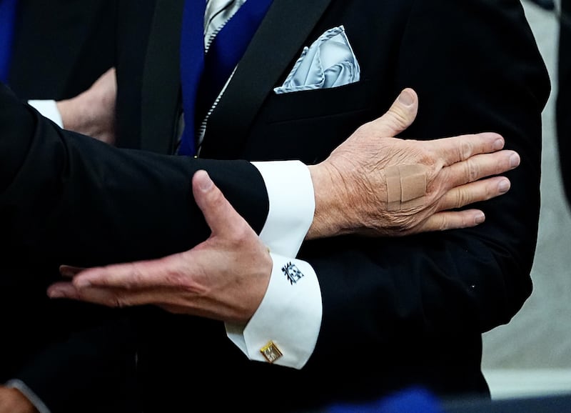 Trump hand with visible bandage