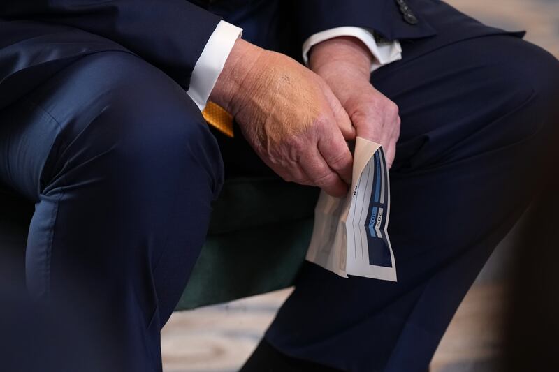 Trump’s hand was seen caked in makeup again.