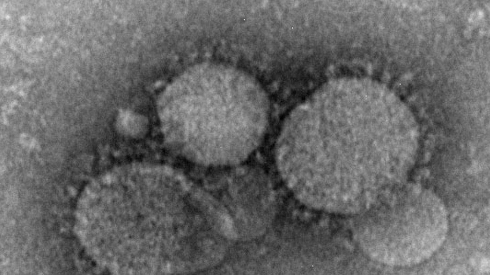 cheats/2013/06/02/mers-infects-two-more/130531-mers-virus-tease_f0a56v