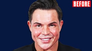 Bobby Norris for the Looker - Before.