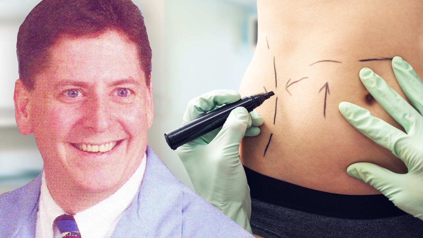 170516-briquelet-barn-lipo-tease_wzqegx