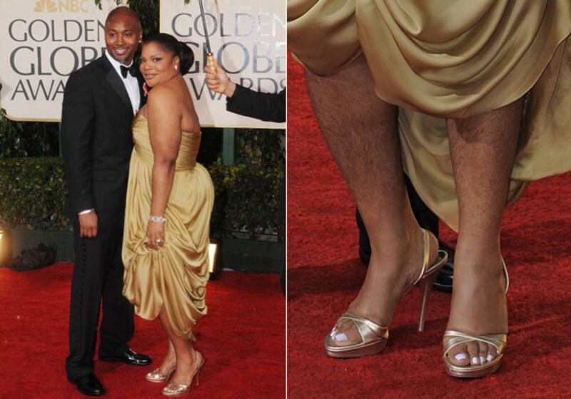 galleries/2010/01/19/wild-and-woolly-stars/hairy-celemonique_i0kagk