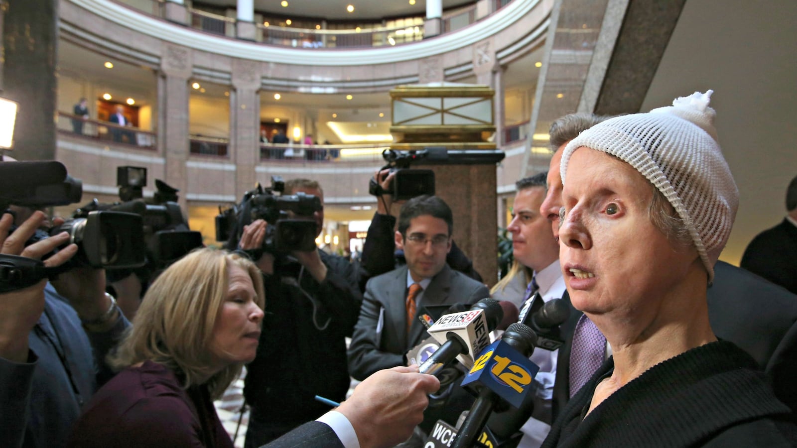 cheats/2016/05/04/chimp-victim-s-body-rejects-face-transplant/160504-charla-nash-cheat_df8bxh