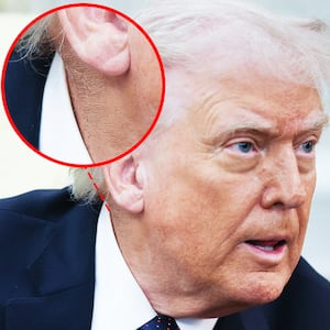 A circle highlighting makeup covering a rash on Trump's neck. President Donald Trump answers questions while meeting with German Chancellor Friedrich Merz in the Oval Office of the White House March 3, 2026 in Washington, DC.